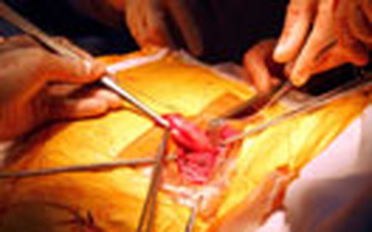 Bị cắt thực quản khi phẫu thuật u tuyến giáp